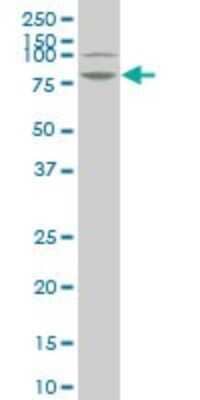 Western Blot: LIM Kinase 1 Antibody (2E9) [H00003984-M05]