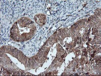 Immunohistochemistry-Paraffin: LIM Kinase 1 Antibody (OTI3H6) [NBP2-00748]