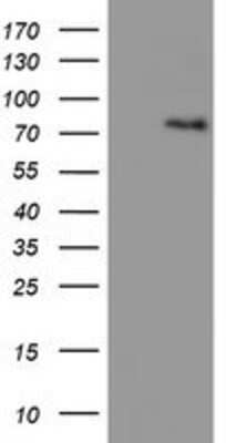 Western Blot: LIM Kinase 1 Antibody (OTI3H6) [NBP2-00748]