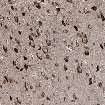 Immunohistochemistry-Paraffin: LIM Kinase 1 Antibody [NBP1-87721]