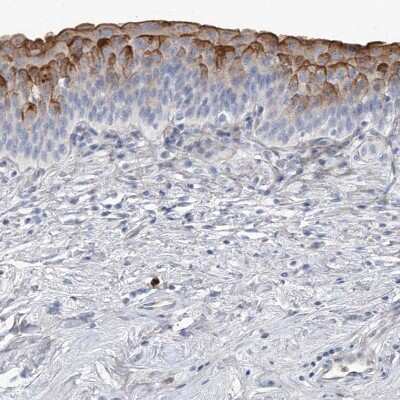 Immunohistochemistry-Paraffin: LIM Kinase 1 Antibody [NBP1-87722]