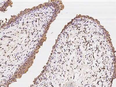 Immunohistochemistry-Paraffin: LIM Kinase 1 Antibody [NBP2-97870]