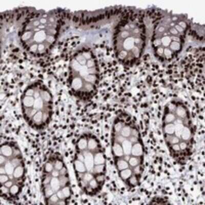 Immunohistochemistry-Paraffin: LIM Kinase 1 Antibody [NBP3-17638]
