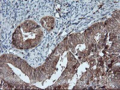 Immunohistochemistry: LIM Kinase 1 Antibody (OTI3H6) - Azide and BSA Free [NBP2-71141]