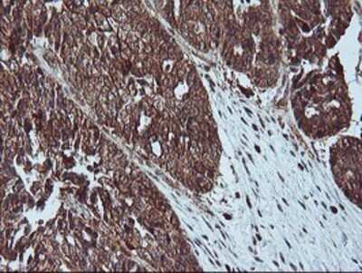 Immunohistochemistry: LIM Kinase 1 Antibody (OTI3H6) - Azide and BSA Free [NBP2-71141]