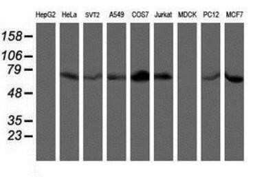 Western Blot: LIM Kinase 1 Antibody (OTI3H6)Azide and BSA Free [NBP2-71141]