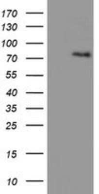 Western Blot: LIM Kinase 1 Antibody (OTI3H6)Azide and BSA Free [NBP2-71141]