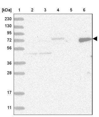 Western Blot: LIM Kinase 1 Antibody [NBP1-87722]