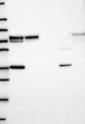 Western Blot: LIM Kinase 1 Antibody [NBP3-17638]