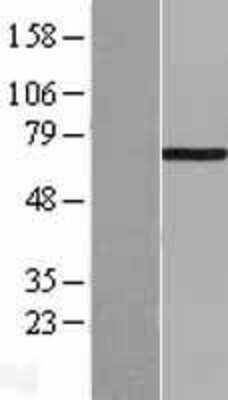 Western Blot: LIM Kinase 1 Overexpression Lysate [NBL1-12536]