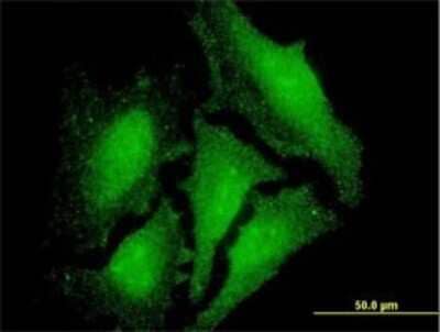 Immunocytochemistry/ Immunofluorescence: LIM domain only 3 Antibody (1A8) [H00055885-M07]