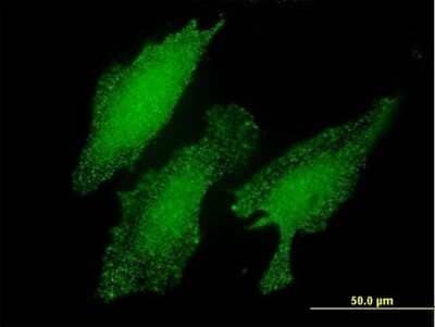 Immunocytochemistry/ Immunofluorescence: LIM domain only 3 Antibody (2H2) [H00055885-M03]