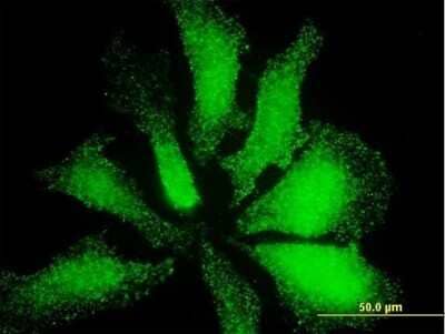 Immunocytochemistry/ Immunofluorescence: LIM domain only 3 Antibody (3G7) [H00055885-M09]