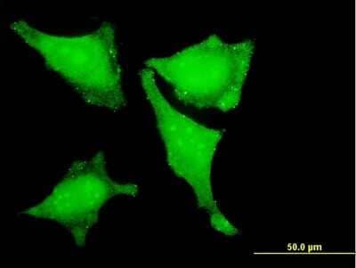 Immunocytochemistry/ Immunofluorescence: LIM domain only 3 Antibody (4A8) [H00055885-M06]