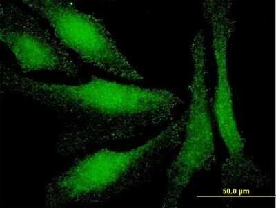 Immunocytochemistry/ Immunofluorescence: LIM domain only 3 Antibody (4C4) [H00055885-M08]