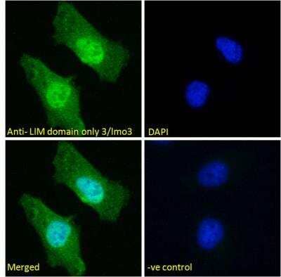 Immunocytochemistry/ Immunofluorescence: LIM domain only 3 Antibody [NBP2-75090]