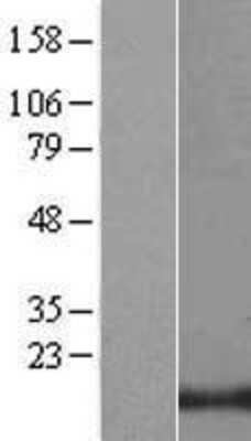 Western Blot: LIM domain only 3 Overexpression Lysate [NBP2-10724]