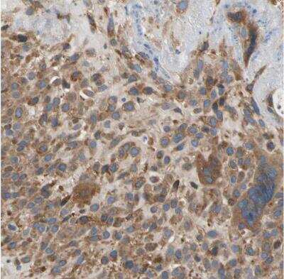 Immunohistochemistry-Paraffin: LIM kinase 2 Antibody [NBP1-85783]
