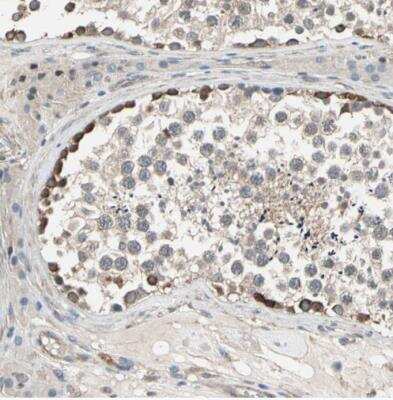 Immunohistochemistry-Paraffin: LIM kinase 2 Antibody [NBP1-85783]