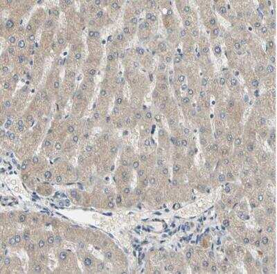 Immunohistochemistry-Paraffin: LIM kinase 2 Antibody [NBP1-85783]