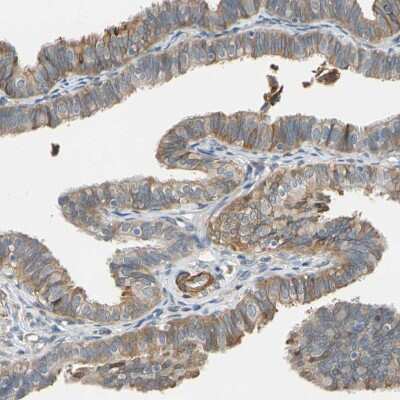 Immunohistochemistry-Paraffin: LIM kinase 2 Antibody [NBP1-85783]
