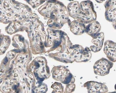 Immunohistochemistry-Paraffin: LIM kinase 2 Antibody [NBP1-85783]