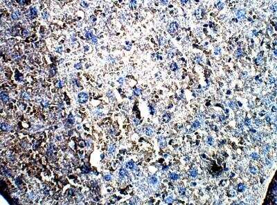 Immunohistochemistry-Paraffin: LIM kinase 2 Antibody [NBP3-12321]