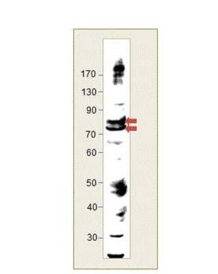 Immunohistochemistry-Paraffin: LIM kinase 2 Antibody [NBP3-12321]