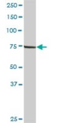 Western Blot: LIM kinase 2 Antibody [H00003985-D01P]