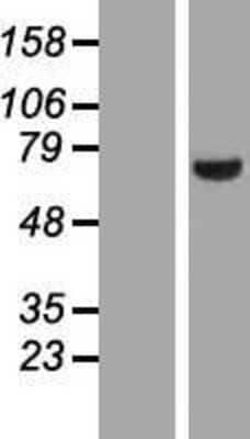 Western Blot: LIM kinase 2 Overexpression Lysate [NBP2-06997]