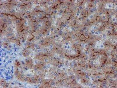 Immunohistochemistry-Paraffin: LIM1 Antibody (OTI2D5) [NBP2-01926]