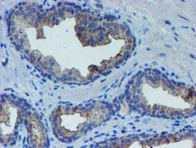 Immunohistochemistry-Paraffin: LIM1 Antibody (OTI2D5) [NBP2-01926]
