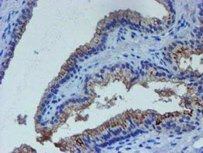 Immunohistochemistry-Paraffin: LIM1 Antibody (OTI2D5) [NBP2-01926]