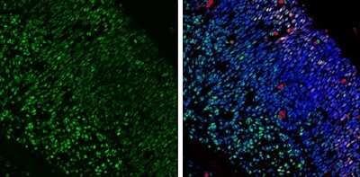 Immunohistochemistry-Frozen: LIM1 Antibody [NBP3-12886]