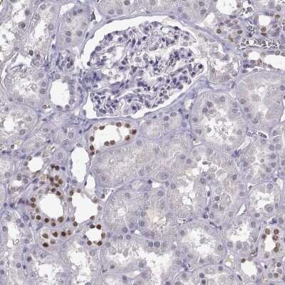 Immunohistochemistry-Paraffin: LIM1 Antibody [NBP2-68955]