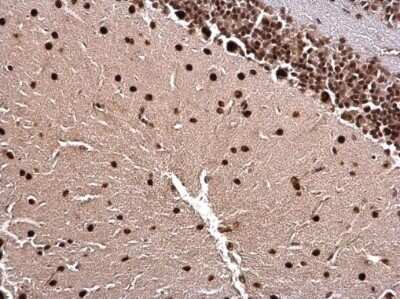 Immunohistochemistry-Paraffin: LIM1 Antibody [NBP3-12886]