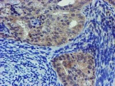 Immunohistochemistry: LIM1 Antibody (OTI2D5) - Azide and BSA Free [NBP2-71134]