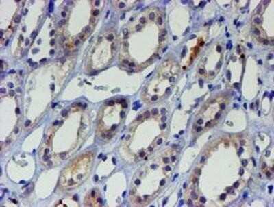 Immunohistochemistry: LIM1 Antibody (OTI2D5) - Azide and BSA Free [NBP2-71134]