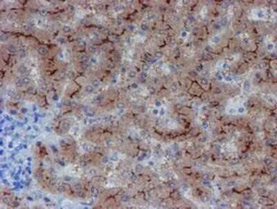 Immunohistochemistry: LIM1 Antibody (OTI2D5) - Azide and BSA Free [NBP2-71134]