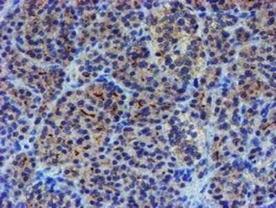 Immunohistochemistry: LIM1 Antibody (OTI2D5) - Azide and BSA Free [NBP2-71134]