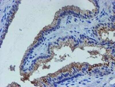 Immunohistochemistry: LIM1 Antibody (OTI2D5) - Azide and BSA Free [NBP2-71134]