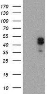 Western Blot: LIM1 Antibody (OTI2D5)Azide and BSA Free [NBP2-71134]