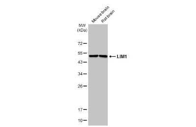 Western Blot: LIM1 Antibody [NBP3-12886]