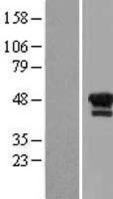 Western Blot: LIM1 Overexpression Lysate [NBL1-12513]