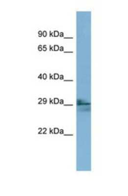 Western Blot: LIM2 Antibody [NBP1-69325]