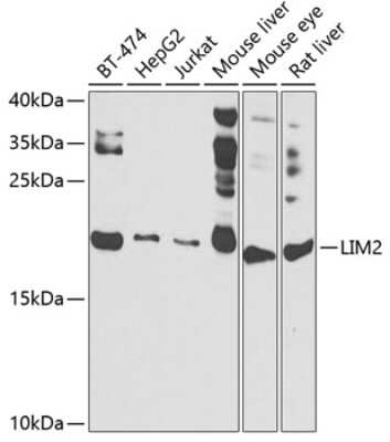 Western Blot: LIM2 AntibodyBSA Free [NBP3-04895]