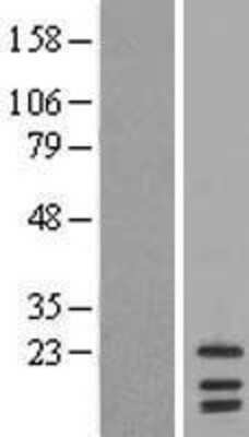 Western Blot: LIM2 Overexpression Lysate [NBL1-12532]