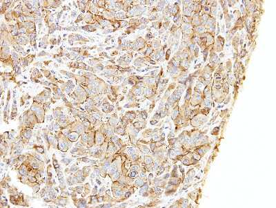 Immunohistochemistry-Paraffin: LIMCH1 Antibody [NBP1-32614]