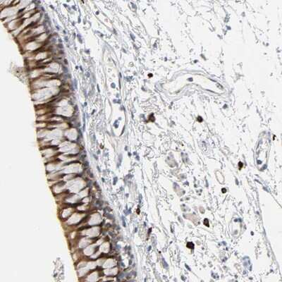 Immunohistochemistry-Paraffin: LIMCH1 Antibody [NBP1-85056]