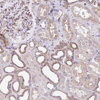 Immunohistochemistry-Paraffin: LIMCH1 Antibody [NBP2-39006]